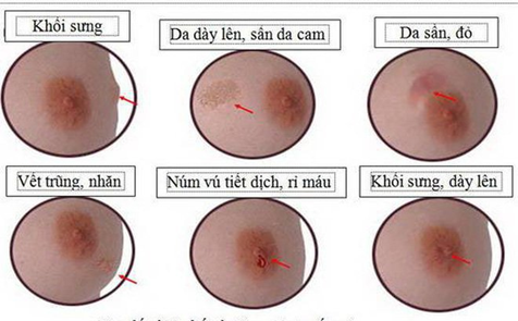 Dịch vụ ung bướu